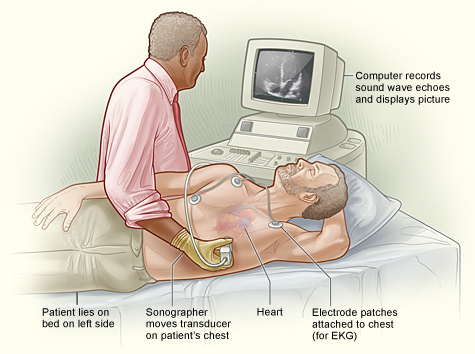 echocardiogram 